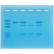 Cancer Gene Detection